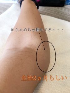 自分の損傷した左腕